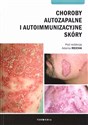 Choroby autozapalne i autoimmunizacyjne skóry  Polish Books Canada