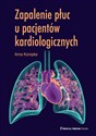 Zapalenie płuc u pacjentów kardiologicznych Canada Bookstore