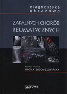 Diagnostyka obrazowa zapalnych chorób reumatycznych Polish bookstore