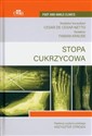 Stopa cukrzycowa  online polish bookstore