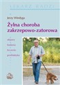 Żylna choroba zakrzepowo zatorowa buy polish books in Usa