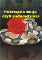 Podstępna żmija, czyli endometrioza - Marzena Grzybowska