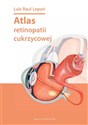 Atlas retinopatii cukrzycowej in polish