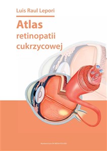 Atlas retinopatii cukrzycowej in polish