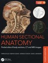 Human Sectional Anatomy Pocket atlas of body sections, CT and MRI images - Harold Ellis, Bari M. Logan, Adrian K. Dixon Polish bookstore