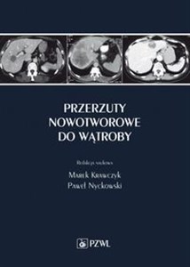 Przerzuty nowotworowe do wątroby  