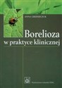 Borelioza w praktyce klinicznej  