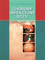 Choroby infekcyjne oczu Kompendium diagnostyki i leczenia books in polish