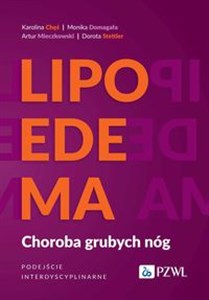 Lipoedema Choroba grubych nóg. Podejście interdyscyplinarne pl online bookstore