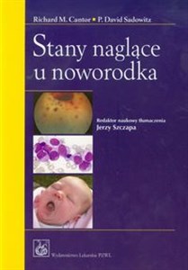 Stany naglące u noworodka Polish bookstore