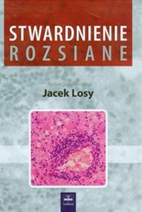 Stwardnienie rozsiane  