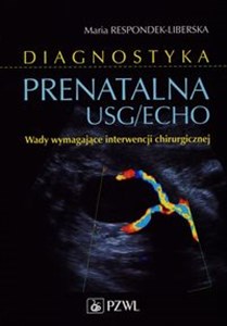 Diagnostyka prenatalna USG/ECHO Wady wymagające interwencji chirurgicznej polish usa