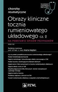 Obrazy kliniczne tocznia rumieniowatego układowego Część 2 W gabinecie lekarza specjalisty. Reumatologia chicago polish bookstore