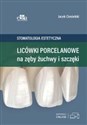Licówki porcelanowe na zęby żuchwy i szczęki Stomatologia estetyczna. - J. Ciesielski