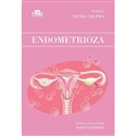 Endometrioza - 
