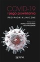 COVID-19 i jego powikłania - przypadki kliniczne Polish bookstore