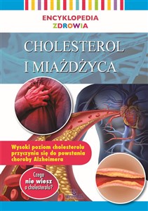 Cholesterol i miażdżyca. Encyklopedia zdrowia in polish