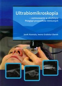 Ultrabiomikroskopia - zastosowanie w okulistyce Przegląd przypadków klinicznych buy polish books in Usa