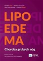 Lipoedema Choroba grubych nóg. Podejście interdyscyplinarne - Karolina Chęś, Monika Domagała, Artur Mieczkowski, Dorota Stettler pl online bookstore