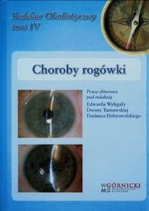 Choroby rogówki Tom 4  buy polish books in Usa