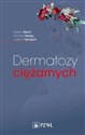 Dermatozy ciężarnych  