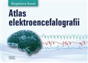 Atlas elektroencefalografii  