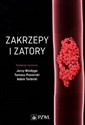Zakrzepy i zatory  - Polish Bookstore USA