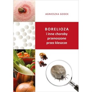 Borelioza i inne choroby przenoszone przez kleszcze bookstore