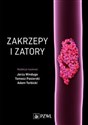 Zakrzepy i zatory Canada Bookstore