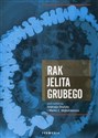 Rak jelita grubego bookstore