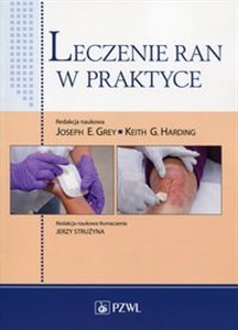 Leczenie ran w praktyce  