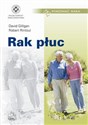 Rak płuc - Polish Bookstore USA