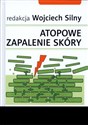 Atopowe zapalenie skóry  