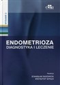 Endometrioza Diagnostyka i leczenie  -   