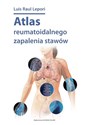 Atlas reumatoidalnego zapalenia stawów / DK Media - Polish Bookstore USA