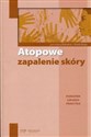 Atopowe zapalenie skóry Poradnik lekarza praktyka in polish