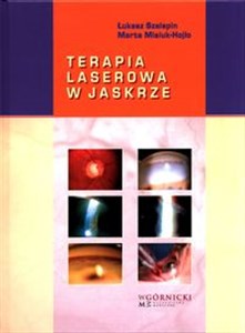 Terapia laserowa w jaskrze pl online bookstore