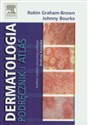 Dermatologia Podręcznik i atlas  