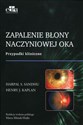 Zapalenie błony naczyniowej oka Bookshop