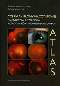 Czerniak błony naczyniowej Diagnostyka różnicowa nowotworów wewnątrzgałkowych Atlas chicago polish bookstore