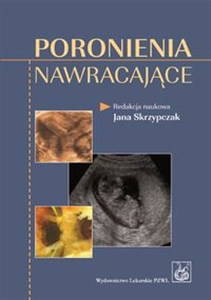 Poronienia nawracające to buy in USA