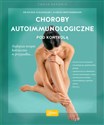 Choroby autoimmunologiczne pod kontrolą - Nicole Schaenzler, Markus Breitenberger