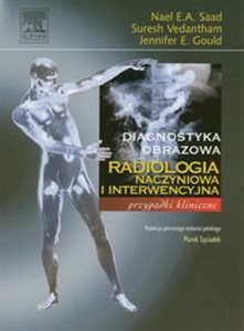 Radiologia naczyniowa i interwencyjna Przypadki kliniczne  