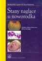 Stany naglące u noworodka Polish bookstore