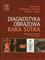 Diagnostyka obrazowa raka sutka Tom 2 books in polish