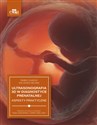 Ultrasonografia 3D w diagnostyce prenatalnej buy polish books in Usa