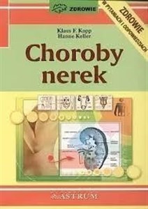 Choroby nerek   