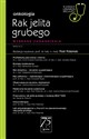 Onkologia Rak jelita grubego W gabinecie lekarza specjalisty Wybrane zagadnienia - Piotr Potemski buy polish books in Usa