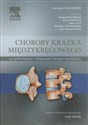 Choroby krążka międzykręgowego Przypadki kliniczne, diagnostyka, leczenie, profilaktyka polish usa