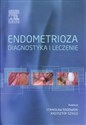 Endometrioza diagnostyka i leczenie -  Canada Bookstore